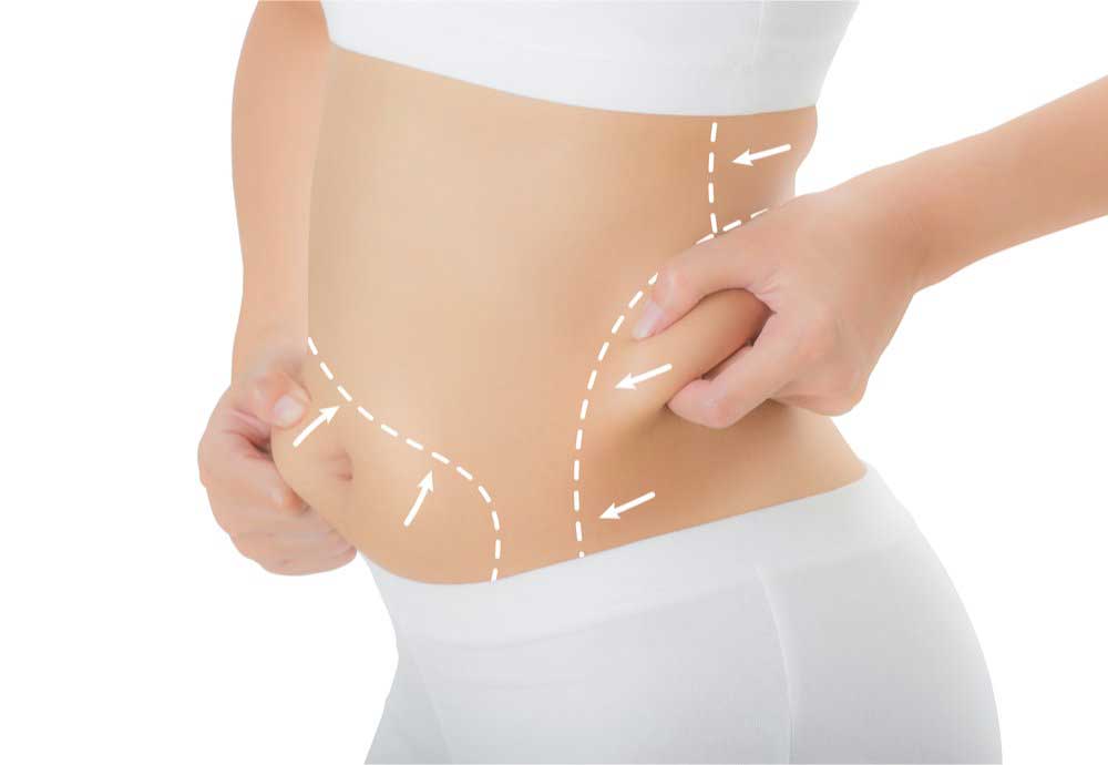 متخصص طب سوزنی اصفهان خدمات لاغری دکتر اردشیر عامری