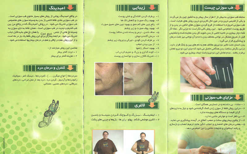 بروشور کلینیک تخصصی دکتر اردشیر عامری به روش طب سوزنی