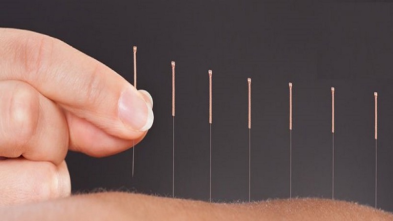 کات گوت یا امبدینگ چه کاربردی دارد