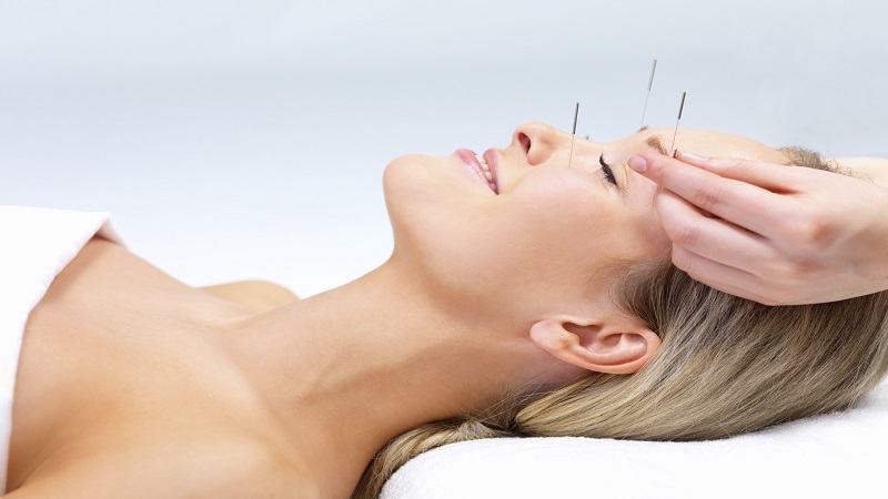 متخصص طب سوزنی اصفهانموفق ترین درمان میگرن با استفاده از طب سوزنی