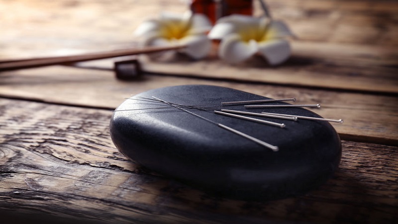 متخصص طب سوزنی اصفهان نکاتی پیرامون طب سوزنی و تاثیر بر لاغری و کاهش وزن
