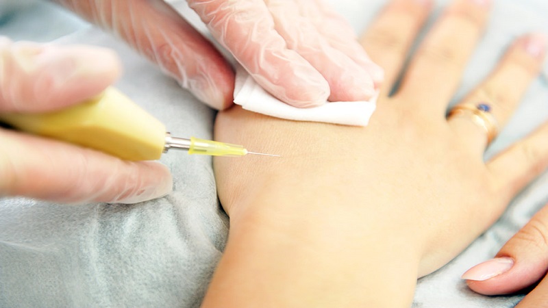 متخصص طب سوزنی اصفهان | درمان کربوکسی تراپی