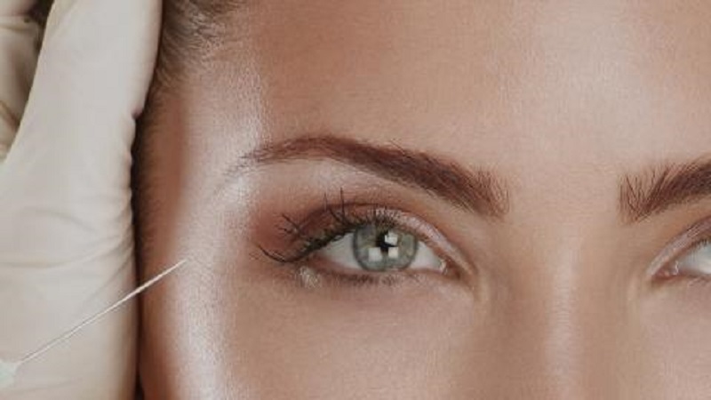 متخصص طب سوزنی اصفهان | اهمیت درمان با کربوکسی تراپی زیر چشم