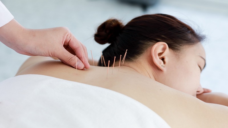 متخصص طب سوزنی اصفهان | درمان مشکلات تیروئید با استفاده از طب سوزنی