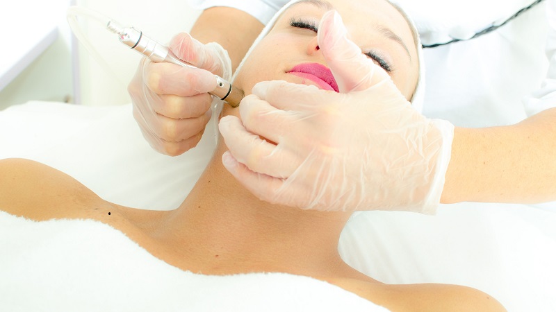 متخصص طب سوزنی اصفهان | چگونگی انجام میکرودرم