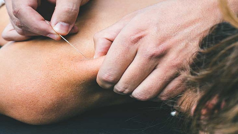 متخصص طب سوزنی اصفهان | کاربردهای طب سوزنی برای دیابت