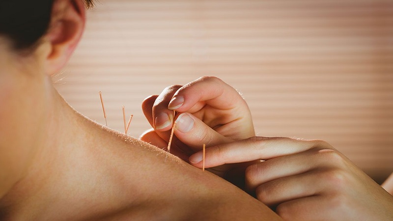 متخصص طب سوزنی اصفهان | تاثیر طب سوزنی در بارداری