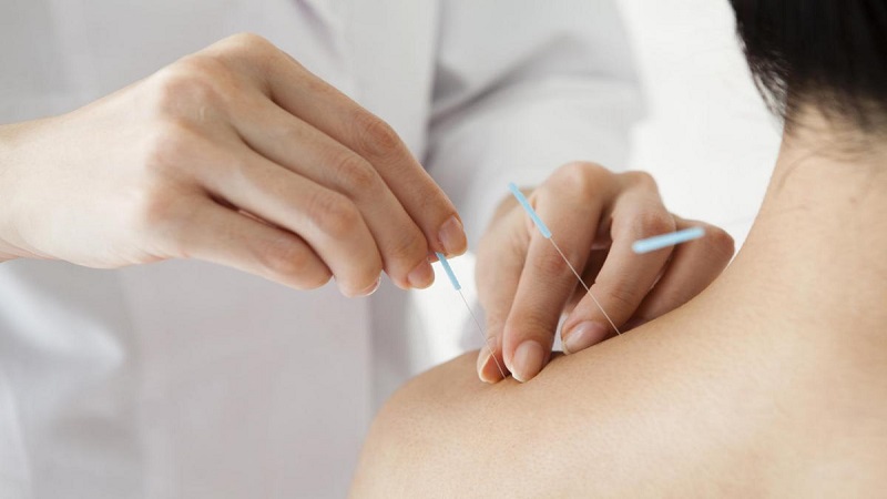 متخصص طب سوزنی اصفهان |افزایش قد با  طب سوزنی