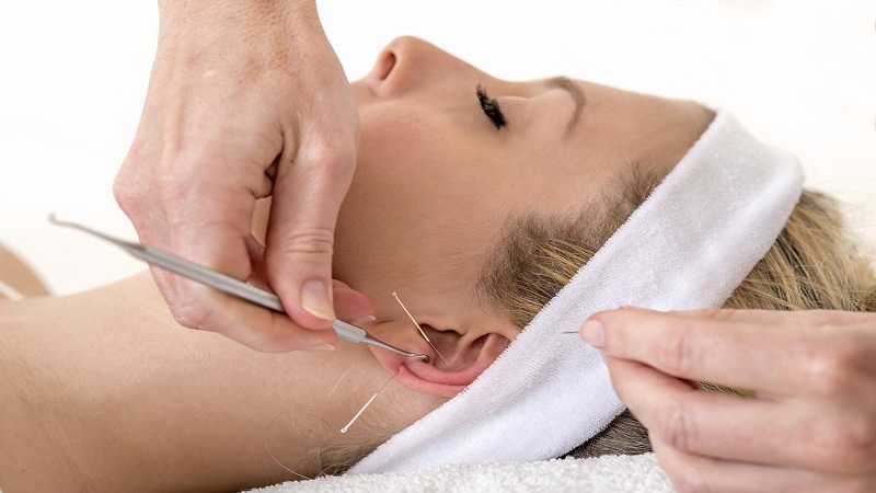 متخصص طب سوزنی اصفهان | اوریکولوتراپی