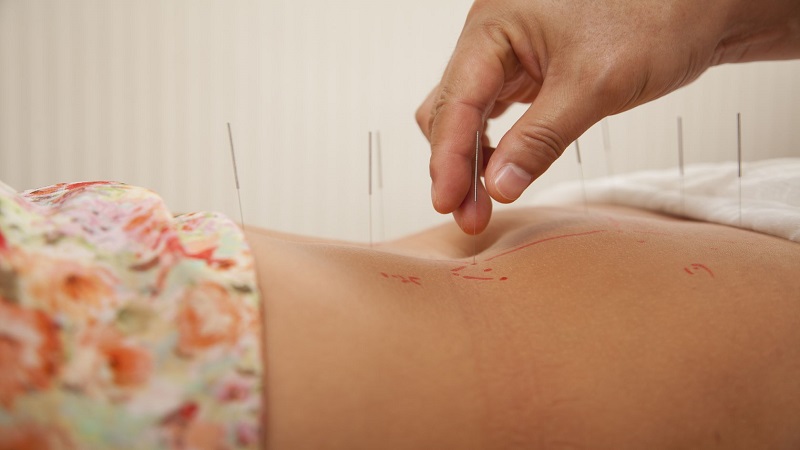 متخصص طب سوزنی اصفهان |درمان کبد چرب با طب سوزنی