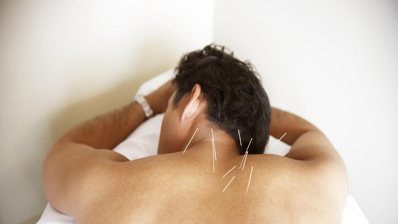 متخصص طب سوزنی اصفهان | طب سوزنی ترک سیگار| 