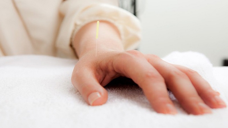 متخصص طب سوزنی اصفهان  |آرتریت روماتوئید و طب سوزنی