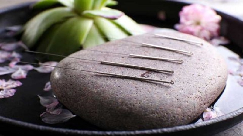 آیا طب سوزنی بر افزایش باروری موثر است؟ | متخصص طب سوزنی اصفهان