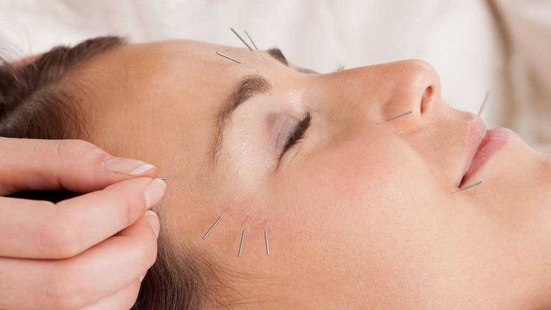 ماسک مغناطیسی برگرفته از طب سوزنی | متخصص طب سوزنی اصفهان