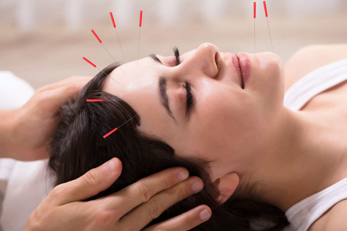 طب سوزنی و روشهای جوانسازی پوست | متخصص طب سوزنی اصفهان