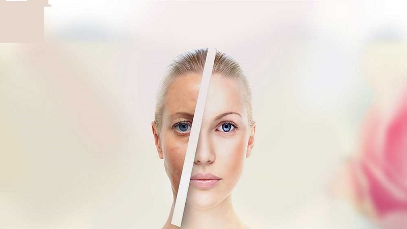 جدیدترین روش های جوانسازی صورت | متخصص طب سوزنی اصفهان