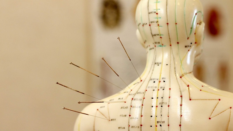 طب سوزنی در درمان درد مفاصل و آرتروز | متخصص طب سوزنی اصفهان