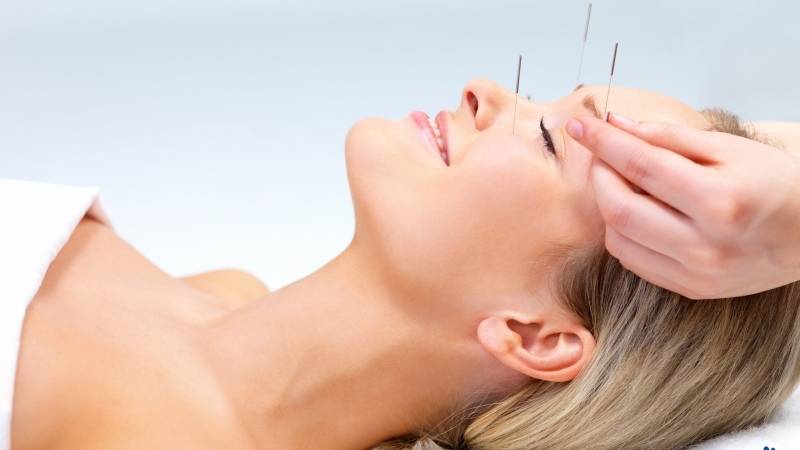 سردرد تنشنی و طب سوزنی | متخصص طب سوزنی اصفهان