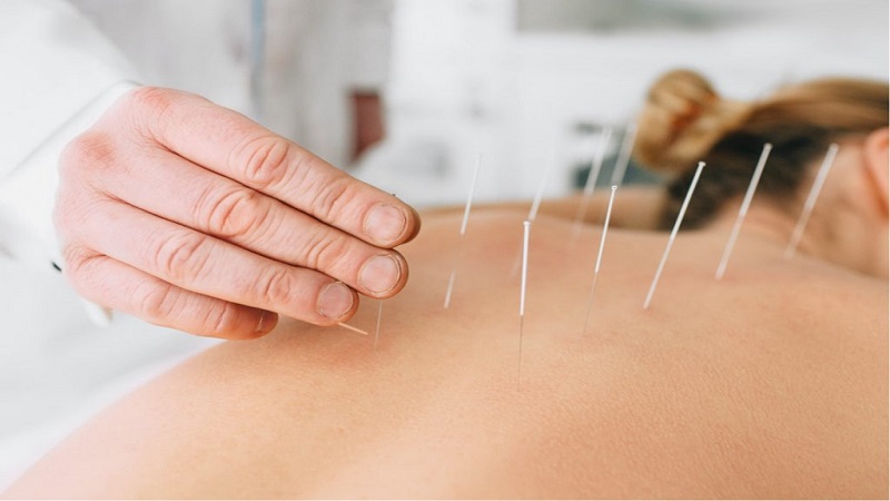 متخصص طب سوزنی اصفهان | تفاوت سوزن خشک با طب سوزنی