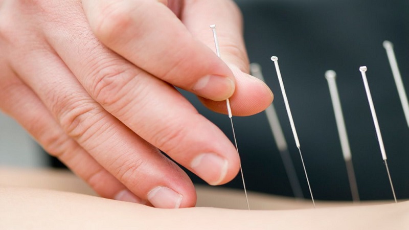 متخصص طب سوزنی اصفهان | درمان ناباروری