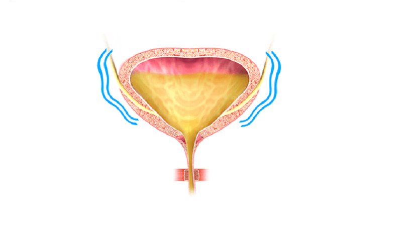 متخصص طب سوزنی اصفهان | تاثیر طب چینی بر بی اختیاری ادرار