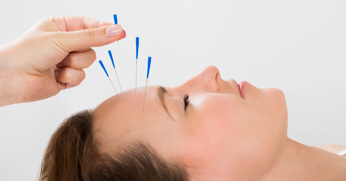 متخصص طب سوزنی اصفهان | اثرات بلند مدت طب سوزنی