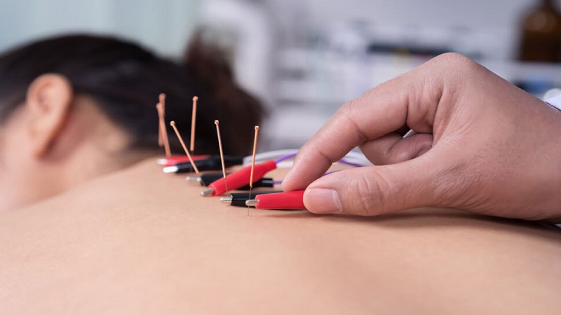 متخصص طب سوزنی اصفهان  | الکترواکوپانکچر در طب سوزنی چه کاربردی دارد؟