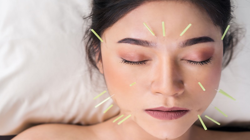 متخصص طب سوزنی اصفهان | درمان افسردگی و طب سوزنی درمانی بدون دارو بدون عارضه