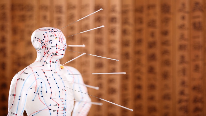 متخصص طب سوزنی اصفهان |فلسفه طب سوزنی و درمان ذهن