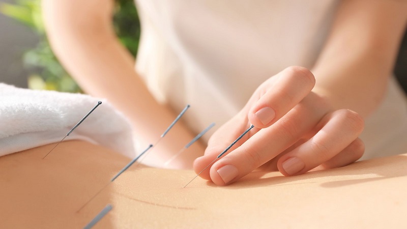 متخصص طب سوزنی اصفهان | کاهش خشکی دهان بیماران سرطانی با کمک طب سوزنی