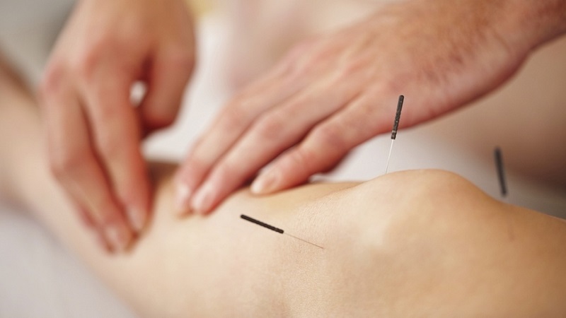 متخصص طب سوزنی اصفهان |درمان اختلالات دهان و دندان با طب سوزنی