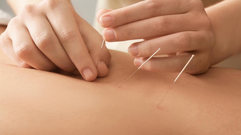 متخصص طب سوزنی اصفهان |درمان آسم
