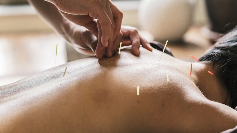 متخصص طب سوزنی اصفهان |درمان تیروئید با طب سوزنی.