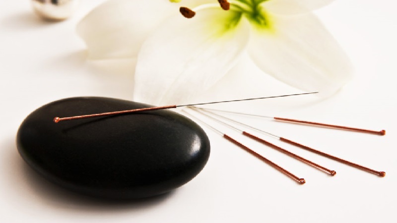 متخصص طب سوزنی اصفهان |سندروم روده تحریک پذیر با طب سوزنی درمان می شود ؟