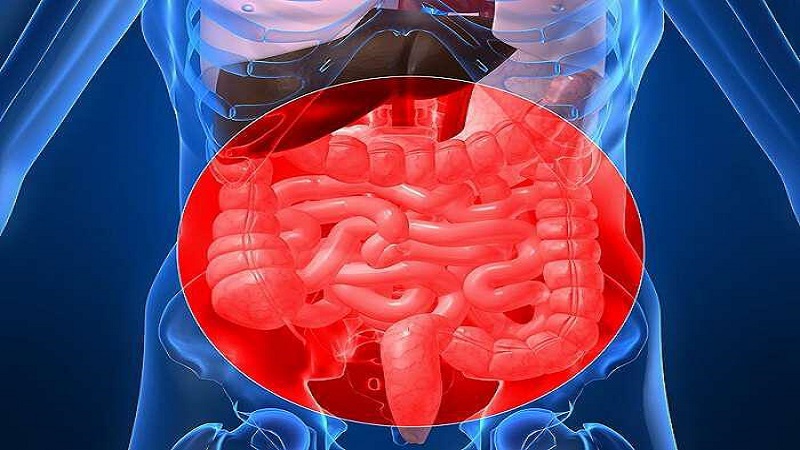 متخصص طب سوزنی اصفهان |سندروم روده تحریک پذیر با طب سوزنی درمان می شود ؟