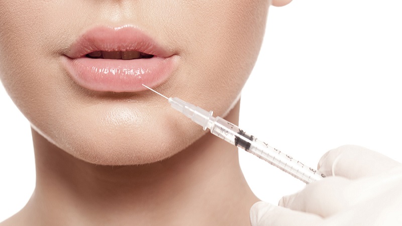 متخصص طب سوزنی اصفهان | تزریق ژل لب طبیعی