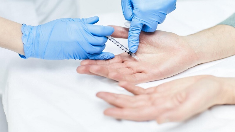 تزریق ژل و بوتاکس اصفهان | درمان تعریق شدید کف دست با کمک تزریق بوتاکس