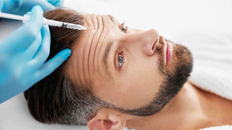 کاشت نخ لاغری اصفهان | دلایل ایجاد خط اخم