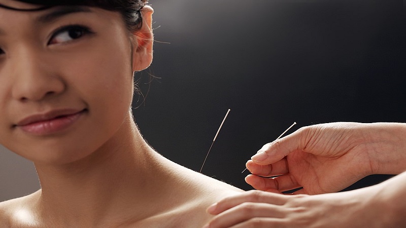 متخصص طب سوزنی اصفهان |تاثیر طب سوزنی بر درمان آگورافوبیا