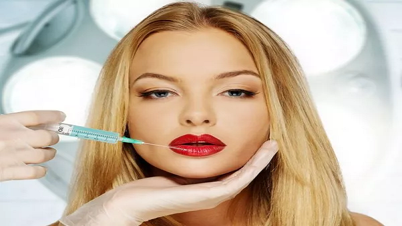 متخصص طب سوزنی اصفهان |تزریق ژل لب عروسکی .