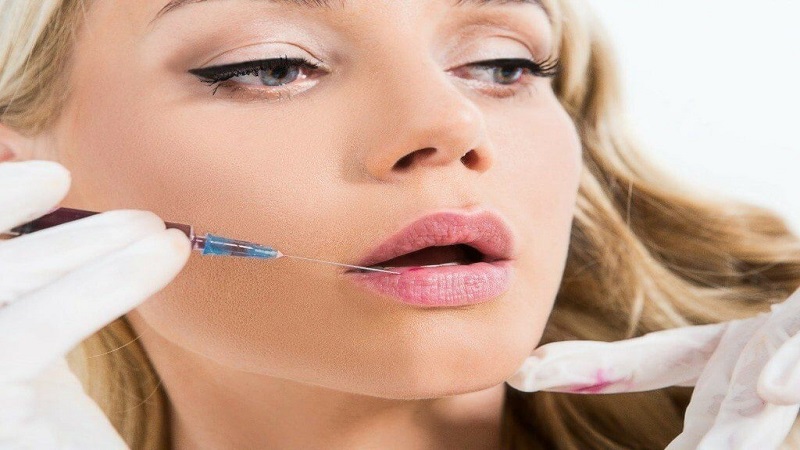  لیفت صورت با نخ اصفهان |تزریق فیلر لب