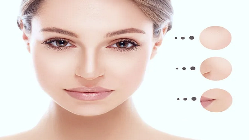  تزریق ژل و بوتاکس اصفهان | درمان Profhilo.
