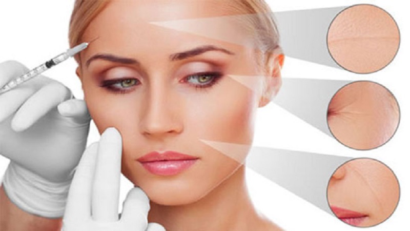 تزریق ژل و بوتاکس اصفهان |کاربرد مزوژل.