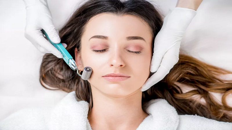 کاشت نخ لاغری اصفهان | عوارض میکرونیدلینگ صورت.