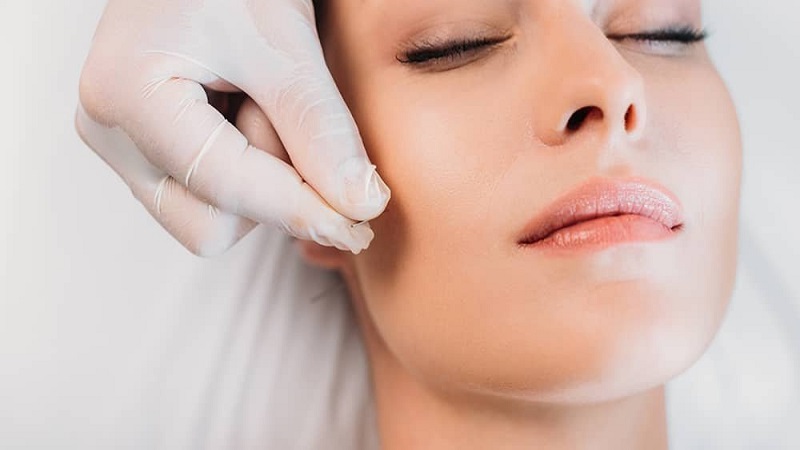 متخصص طب سوزنی اصفهان | طب سوزنی صورت.