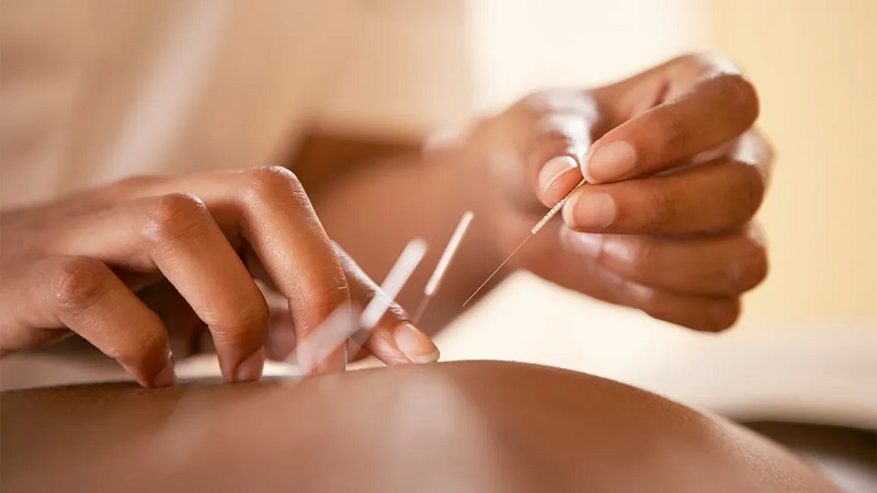 تغذیه مکمل در کنار طب سوزنی برای لاغری پایدار و سلامت متابولیک | لیزر اندولیفت اصفهان | دکتر ادشیر عامری