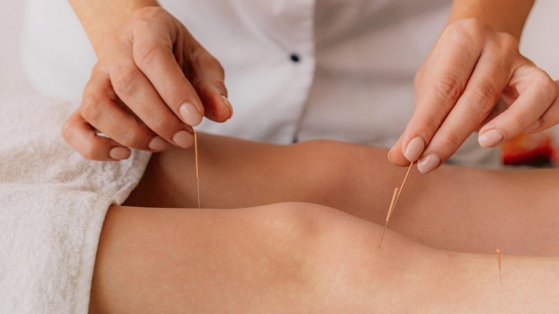 طب سوزنی همراه با سایر روش‌های درمانی در بهبود آرتروز زانو | لیزر اندولیفت اصفهان | دکتر ادشیر عامری