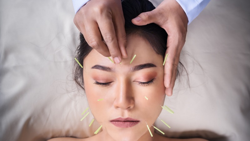 طب سوزنی و بهبود کیفیت خواب: راهکارهایی برای بی‌خوابی مزمن | لیزر اندولیفت اصفهان | دکتر ادشیر عامری