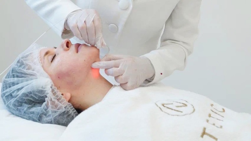 ترکیب لیزر اندولیفت با سایر روش‌های جوانسازی | لیزر اندولیفت اصفهان | دکتر ادشیر عامری