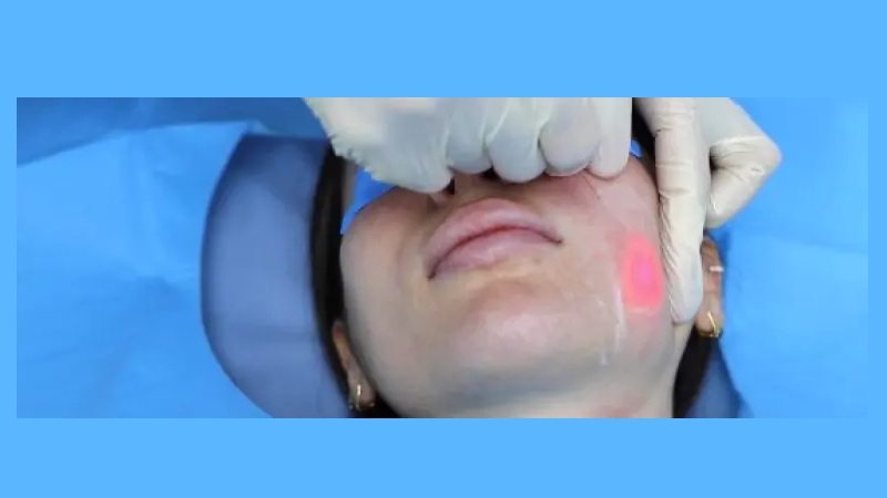 تأثیر اندولیفت بر لایه‌های چربی عمقی | لیزر اندولیفت اصفهان | دکتر ادشیر عامری